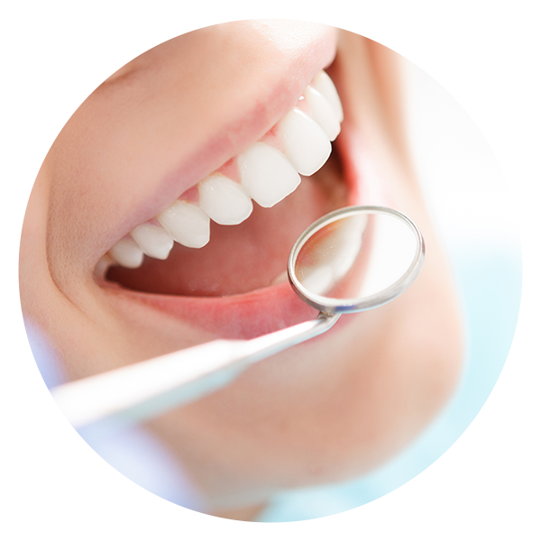 予防歯科・歯周病治療